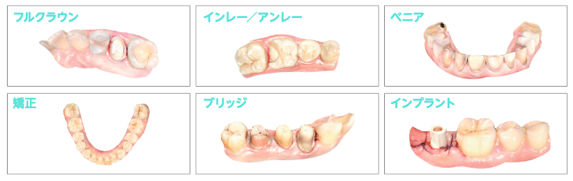 こんな治療にも使える